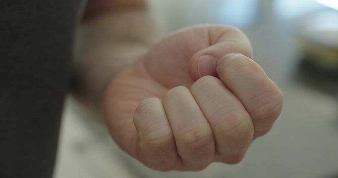 Close-up of a hand picking at skin near fingernails. Concept of stress, anxiety, nervous habit and emotional tension. Mental health and behavioral disorder theme.