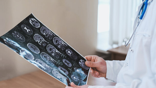 A doctor examines a close-up of a brain MRI in a hospital office. Diagnosis of neurological problems and migraines, stroke, concussion, and head injury.