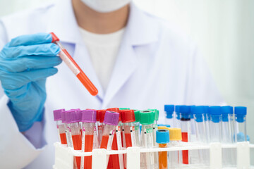 Scientist medical professional use test tube for research in science laboratory. © manassanant
