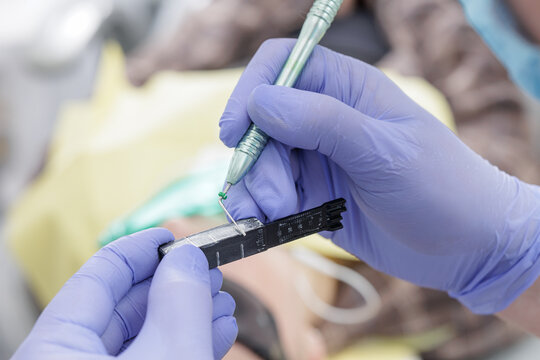 Dentist measuring endodontic file before root canal treatment