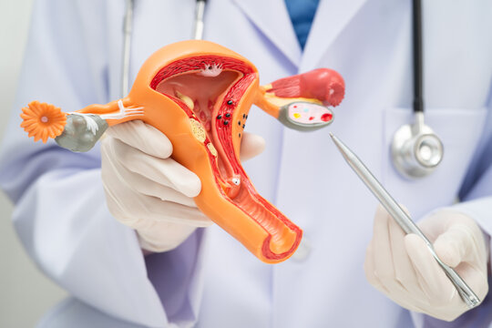 Uterus, doctor holding human anatomy model for study diagnosis and treatment in hospital.
