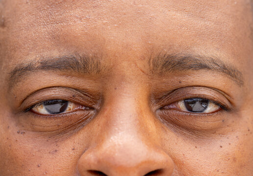 Middle-aged African man gazing in extreme close-up, showing eyes with corneal reflections and skin