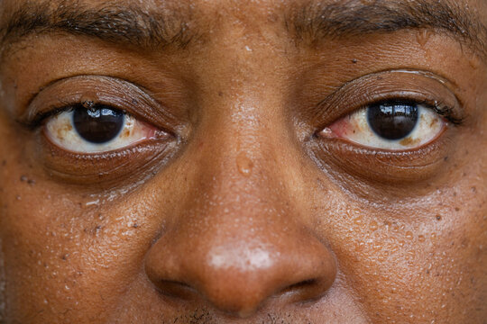 Adult African man holding steady gaze near window, showing moist skin pores and eye reflections