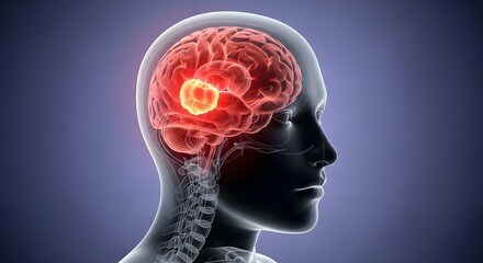 Obraz premium Localized Brain Tumor Highlight Visualization with Intense Red Oncological Focus in Cerebral Region