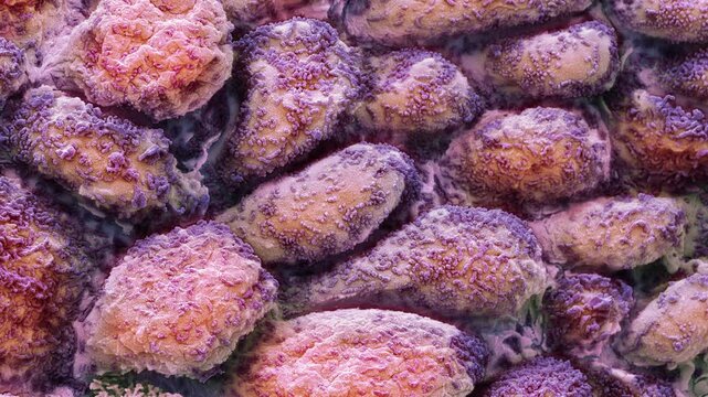 Post menopausal uterus, SEM