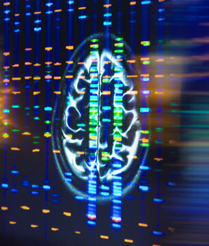 MRI brain scan and DNA strands representing Alzheimer's genetics research