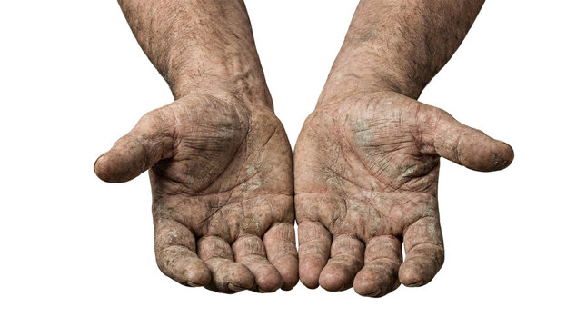 Rough calloused palms of manual labor worker