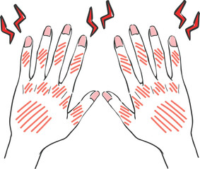 ハンドケア　手荒れ　トラブルのある手　ベクター