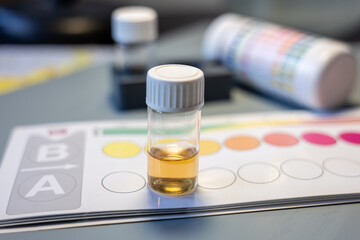 Glass vial with aquarium water sample on color comparison chart of test kit. Water chemistry testing for nitrate and nitrite levels in aquarium nitrogen cycle