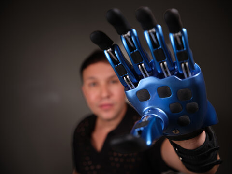  Man with bionic prosthetic arm touching head, thinking or brainstorming concept.