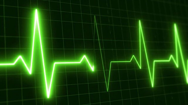 Vibrant green electrocardiogram line pulsing on a dark monitor screen
