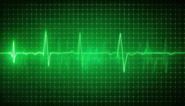 Green Heartbeat Line on Monitor Displaying Vital Signs.