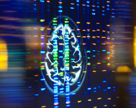 Digital brain MRI scan with DNA strands for neurology and genetics research