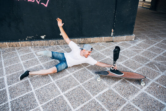 Amputated young man having fun with leg prosthesis and skateboard