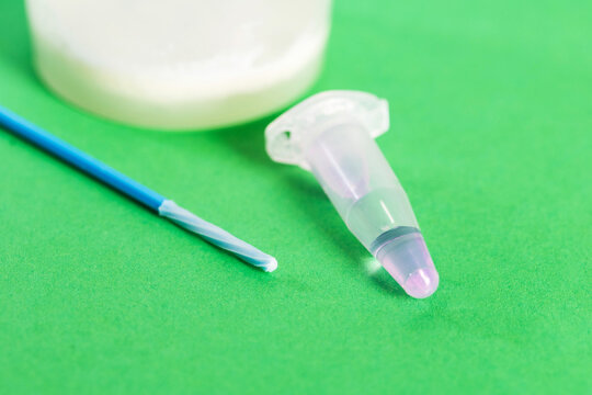 A urethral swab and ejaculate sample are taken to check for inflammation and infections in the reproductive organs. Inflammation, prostatitis