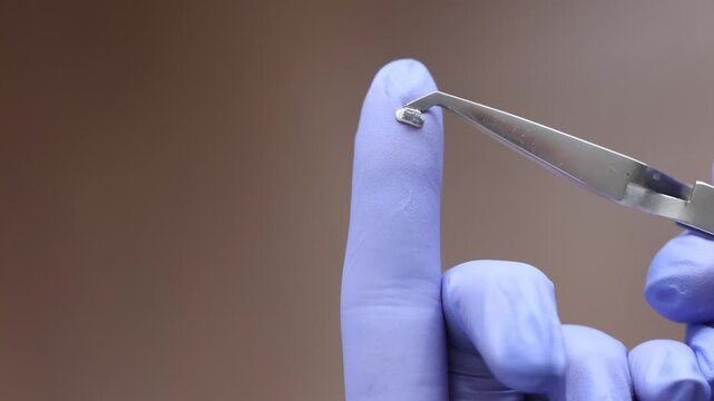 Orthodontic metal bracket used for dental braces treatment presented in macro detail revealing small precision component responsible for guiding arch wire and controlled tooth movement