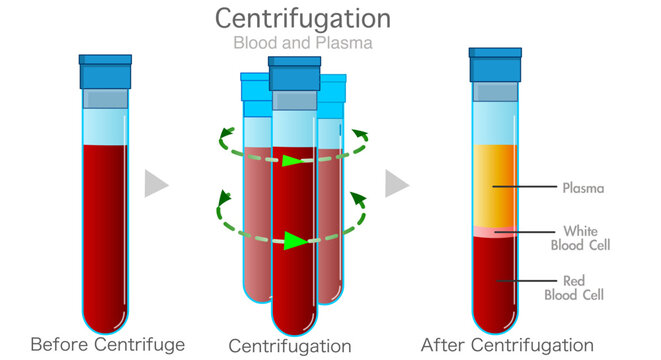 Blood centrifugation before after. Blood plasma anatomy. Spinning vessel of fresh blood structure. White, red blood cell human platelet. Separated WBC RBC buffy coat in lab tube. Vector illustration 