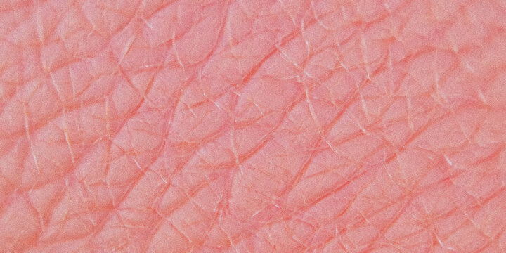 Close up view of human skin texture displaying delicate lines and redness