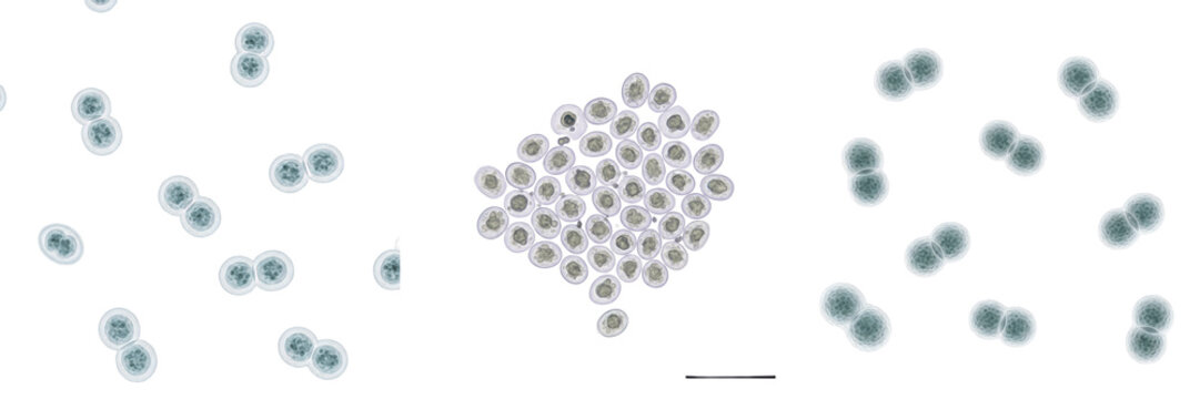 Chlamydia trachomatis bacteria isolated on white background, Chlamydia trachomatis intracellular bacterium causing chlamydia infection, pathogenic microorganism studied in clinical microbiology labora