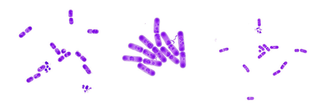 Providencia stuartii bacteria isolated on white background, Providencia stuartii gram negative rod bacterium, opportunistic pathogen associated with urinary tract infection studied in clinical microbi