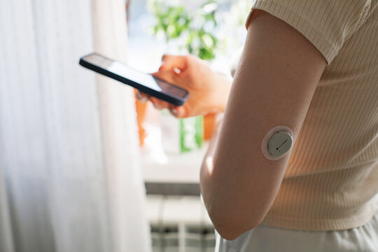 MINSK, BELARUS - MARCH 2026: A woman with diabetes in light homewear synchronizes an installed Dexcom One+ Continuous Glucose Monitoring device with her smartphone.