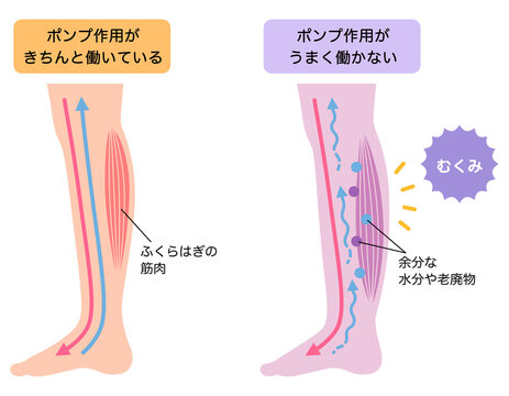 脚のむくみ　浮腫のしくみ