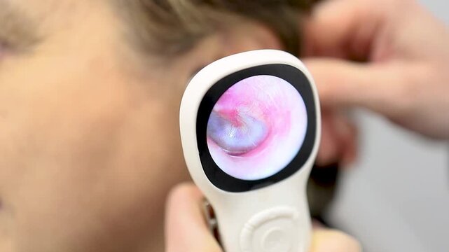 Video of an unrecognizable 60-year-old woman undergoing hearing tests at a medical center. Her ears are examined with a video otoscope. Image of an otolaryngologist.