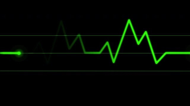 Heartbeat Green Pulse Signal Line Loop Animation on Digital ECG Medical Monitor Display. medical pulse monitor background