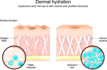Human skin. Hyaluronic acid, Dermal moisture and Wrinkles formation