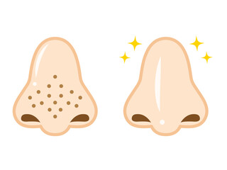 毛穴汚れが目立つ鼻のイラスト素材