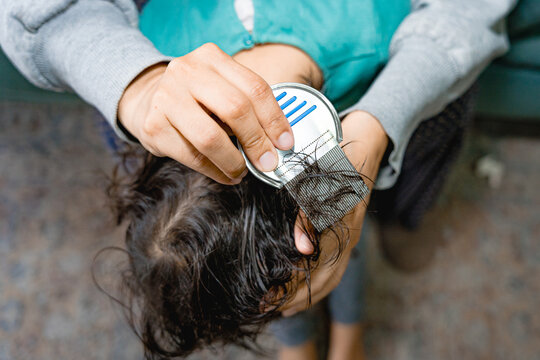 closeup of lice and nits removal with lice comb on baby girl head hair by hand. Treatment against lice and nits on children