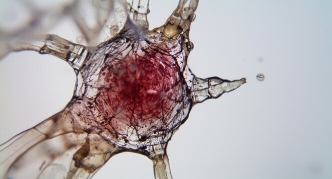 Magnified depiction of an unusual cell observed via 1000x microscope