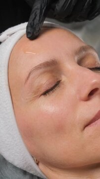 Aesthetic medicine professional injecting platelet rich plasma into a woman's forehead