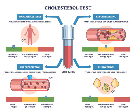 Cholesterol test lipid panel shows LDL, HDL, and triglycerides with blood vial and artery graphics, explaining risk levels and ranges, transparent background.