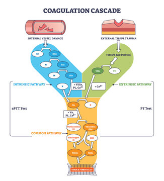 Coagulation cascade outline shows intrinsic and extrinsic pathways converging to a stable fibrin clot, key elements, tissue factor, thrombin, fibrin, transparent background.