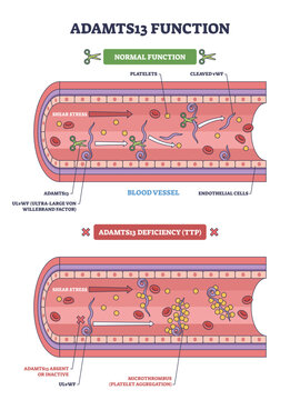 ADAMTS13 function, enzyme cleaves vWF in a blood vessel to limit platelet clumps, deficiency leads to TTP microthrombi, transparent background.Key objects, platelets, vWF, vessel.