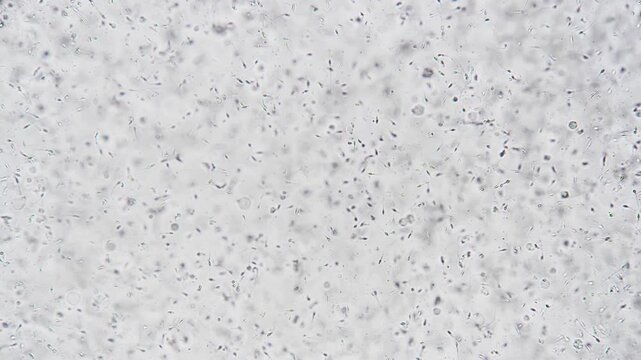 Dense microscopic sperm field showing active motility, research scientist conducting CASA tracking for fertility study numerous motile spermatozoa across slide under clinical lighting.