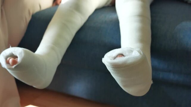 Childs legs in plaster casts sitting down on sofa showing toes movement