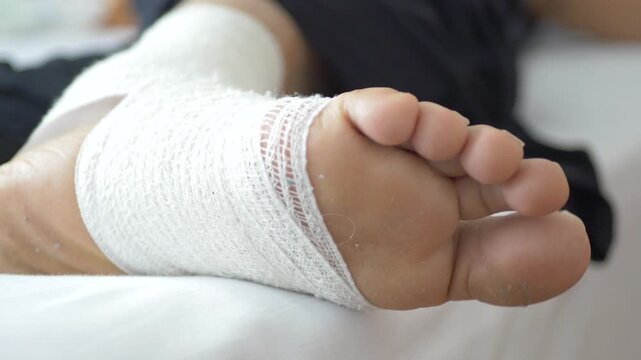 Close up of a bandaged foot with toes wiggling on a white bed, showing recovery and rehabilitation motion