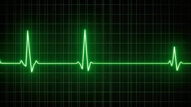 Glowing green electrocardiogram heart rate monitor line on a dark grid background for medical healthcare concept