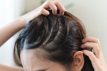 Fototapeta premium Young woman scratching her head feeling itch from dermatology problem