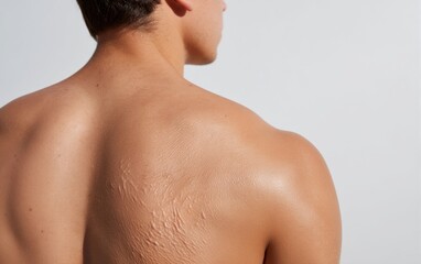 Naklejka premium Close-Up View of Back with Textured Skin and Patches in Natural Light