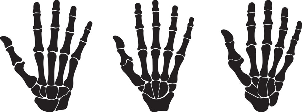Skeleton Hand Vector Pack: Bone X‑Ray Silhouettes .