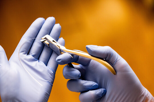 Orthodontic pliers manipulating thin archwire during braces adjustment highlighting delicate orthodontic wire control and precision dental work performed by orthodontist in clinical setting