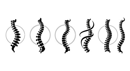 Human spine illustrations showing different curvatures and deformities.