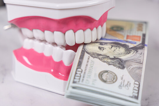 Un mod&egrave;le 3D de dentier tenant de l'argent, signifiant les frais dentaires.