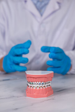 Gros plan sur un appareil dentaire ouvert. En arri&egrave;re plan, un dentiste avec des gants bleus en nitrile est habill&eacute; avec une blouse blanche m&eacute;dicale. L'image est au format vertical.