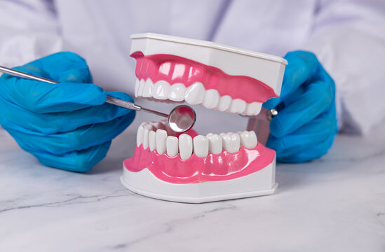 Gros plan sur un dentiste qui inspecte avec un miroir dentaire un mod&egrave;le 3D de dentier. 