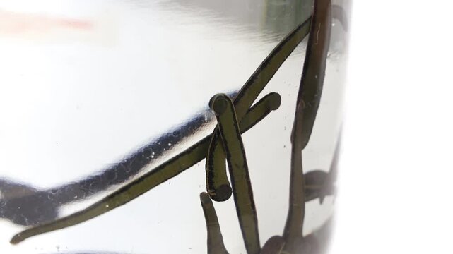 Hirudotherapy treatment with leeches at a medical clinic