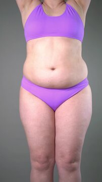Overweight woman showing fat before liposuction or tummy tuck, featuring shaking and jiggling flabby, saggy excess weight on her belly, lymph drainage massage